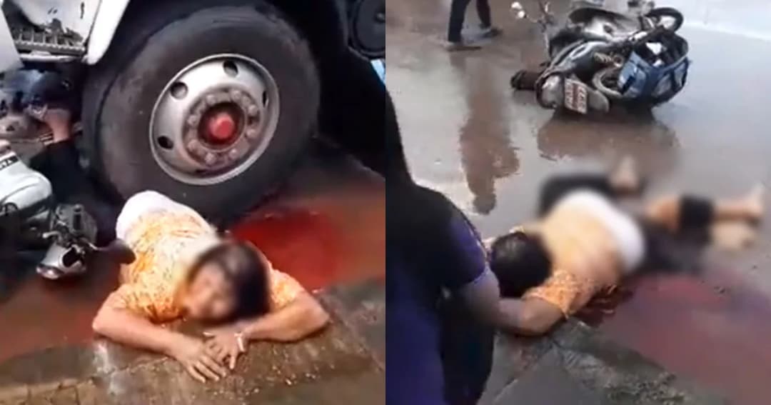 วิจารณ์ 2 ด้าน ! ยายถูกรถทับขาเจ็บสาหัส ทำไมไม่รีบช่วยชีวิต