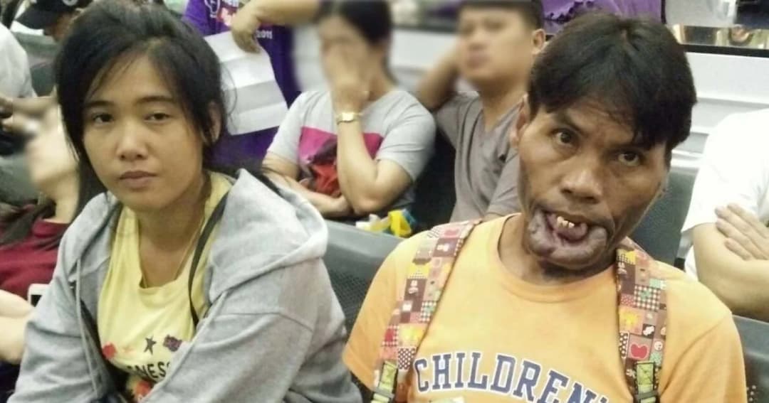 ‘พี่มีมี่’ พร้อมหล่อแล้ว ควงภรรยาคนสวย รอแพทย์จุฬาฯ ผ่าตัดศัลยกรรม