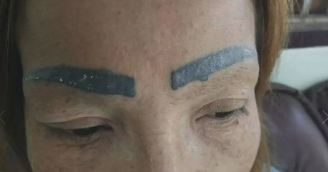 สาวสักคิ้ว 200 หวังสวย แต่กลับพัง ไม่กล้าออกนอกบ้าน