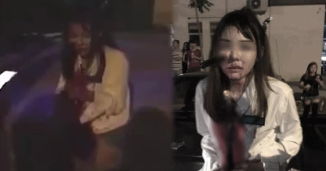 สาวมาเลย์โดนมีดปักแก้มมิด หลังถูกโจรดักฉกกระเป๋าในเมืองปีนัง