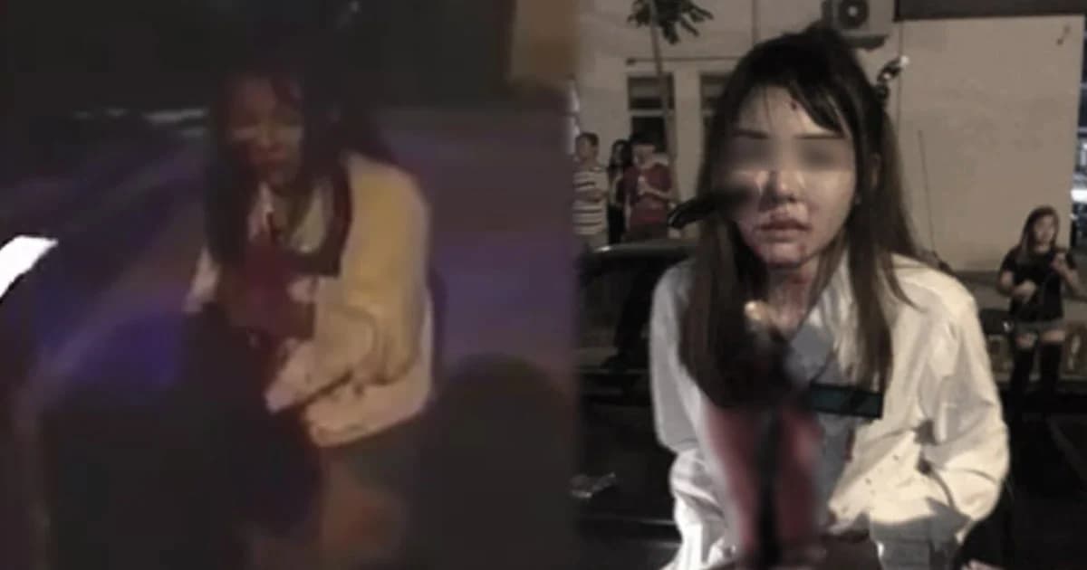 สาวมาเลย์โดนมีดปักแก้มมิด หลังถูกโจรดักฉกกระเป๋าในเมืองปีนัง