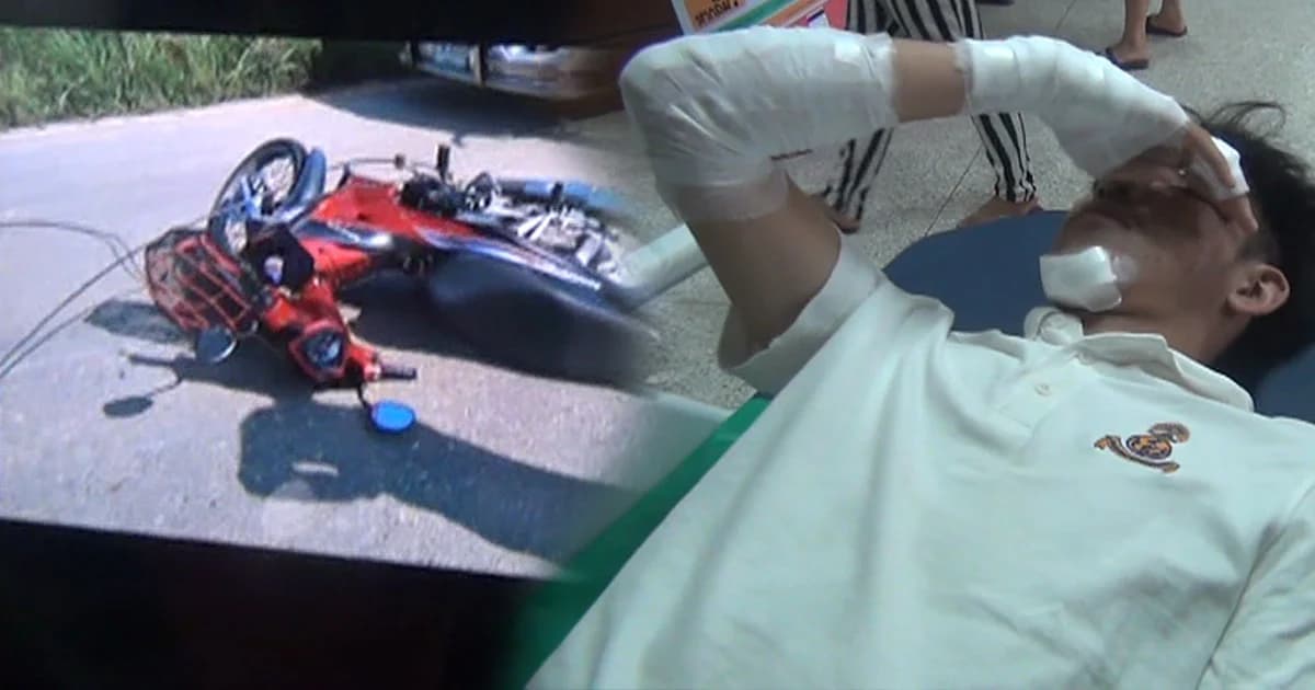 หวิดคอขาด! สายไฟเกี่ยวคอหนุ่ม 19 เคราะห์ดีสวมหมวกกันน็อกเต็มใบ