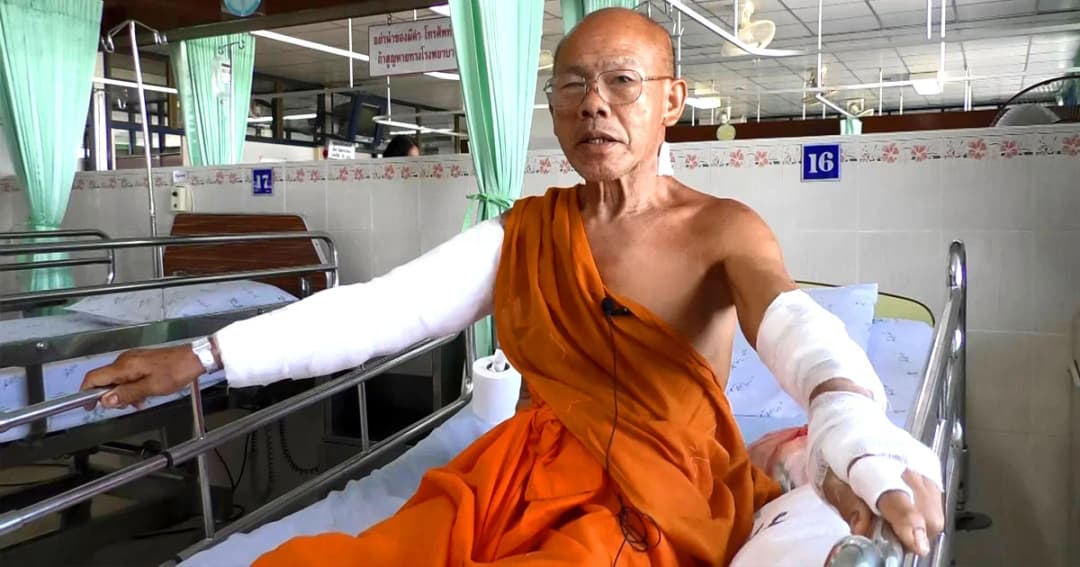 คืบหน้า ‘หลวงพ่อ’ เผย เหตุการณ์ถูก ‘พิทบูล’ เกือบ 10 ตัว รุมขย้ำ