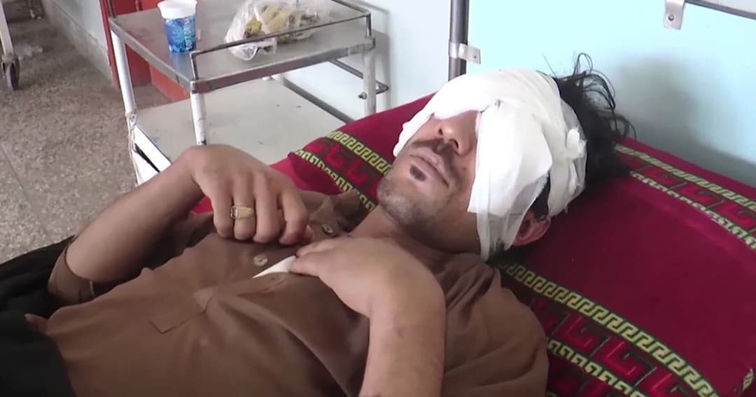 พ่อ-พี่ชายโหด ! ควักลูกตาลูกชาย 2 ข้างทิ้ง เหตุไม่ยอมถูกคลุมถุงชน