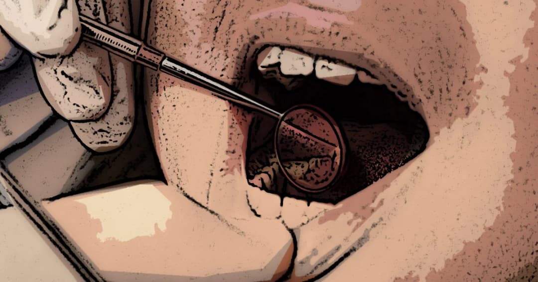 เด็กอังกฤษถูกถอนฟันผุ 60,000 คน ปีที่แล้ว ทางการเริ่มจริงจัง