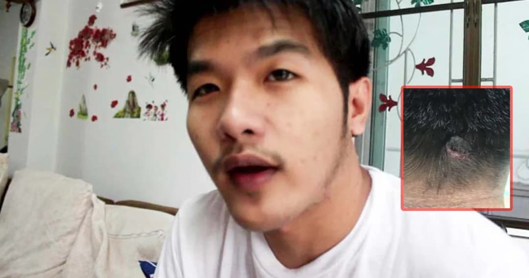 หนุ่มถูกยิงผิดตัว กระสุนยังฝังหัว รูปคดีเงียบ ไร้คนเยียวยา