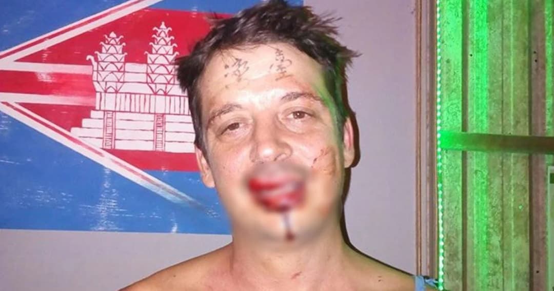 แก๊งจีนเดือด รุมชกหนุ่มอังกฤษ หลังเห็นคำว่า ‘ไต้หวัน’ บนหน้าผาก