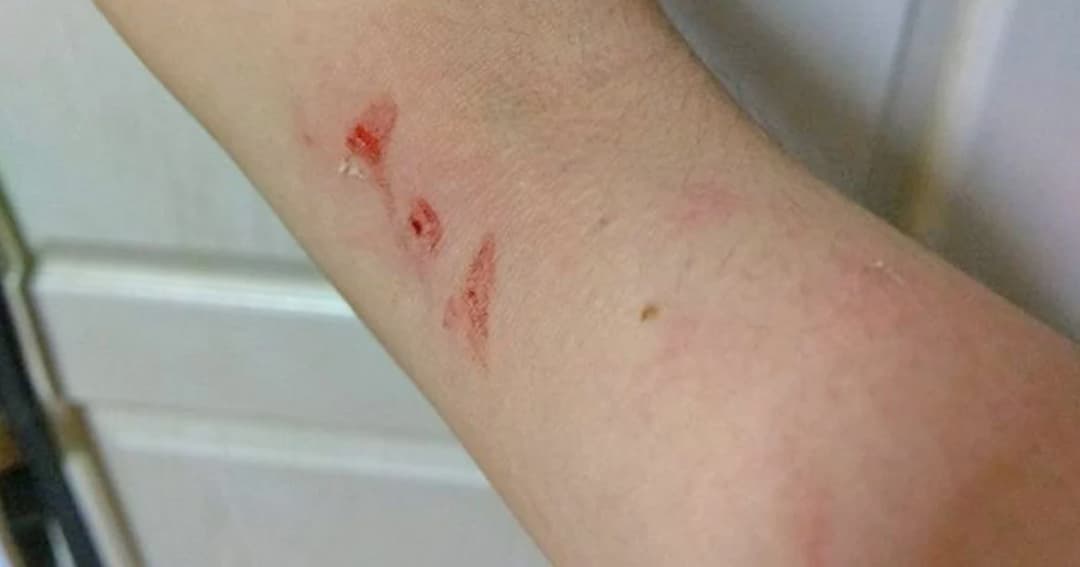 มนุษย์ป้าขับรถตู้วินไทรน้อยเก็บเงินเกินราคา-ด่าหยาบ ผดส.สาว ซ้ำวิ่งตามลงมาจิกหัว-แขน