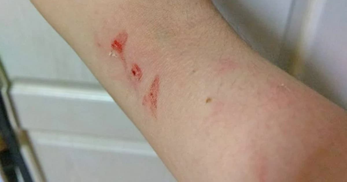 มนุษย์ป้าขับรถตู้วินไทรน้อยเก็บเงินเกินราคา-ด่าหยาบ ผดส.สาว ซ้ำวิ่งตามลงมาจิกหัว-แขน