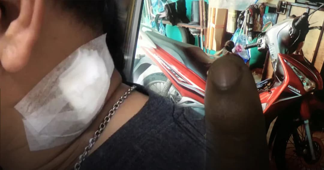 ปล้นโหด ! โจ๋แสบทำทีเป็นลูกค้าลวงวินขับส่งป้าย ใช้มีดปักคอขโมย จยย.หนี