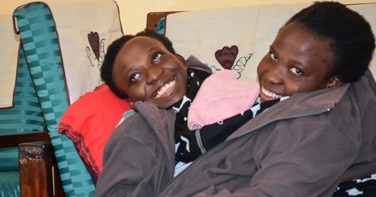 แฝดหญิงลำตัวติดกันชาวแทนซาเนีย เสียชีวิต