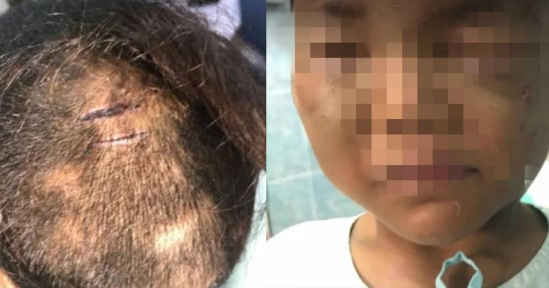 หนุ่มร้อง ! เด็ก 7 ขวบถูกแม่ทิ้ง โดนทำร้ายปางตาย