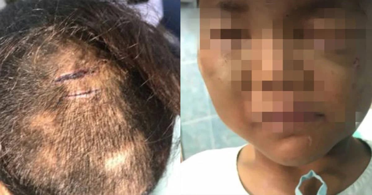 หนุ่มร้อง ! เด็ก 7 ขวบถูกแม่ทิ้ง โดนทำร้ายปางตาย