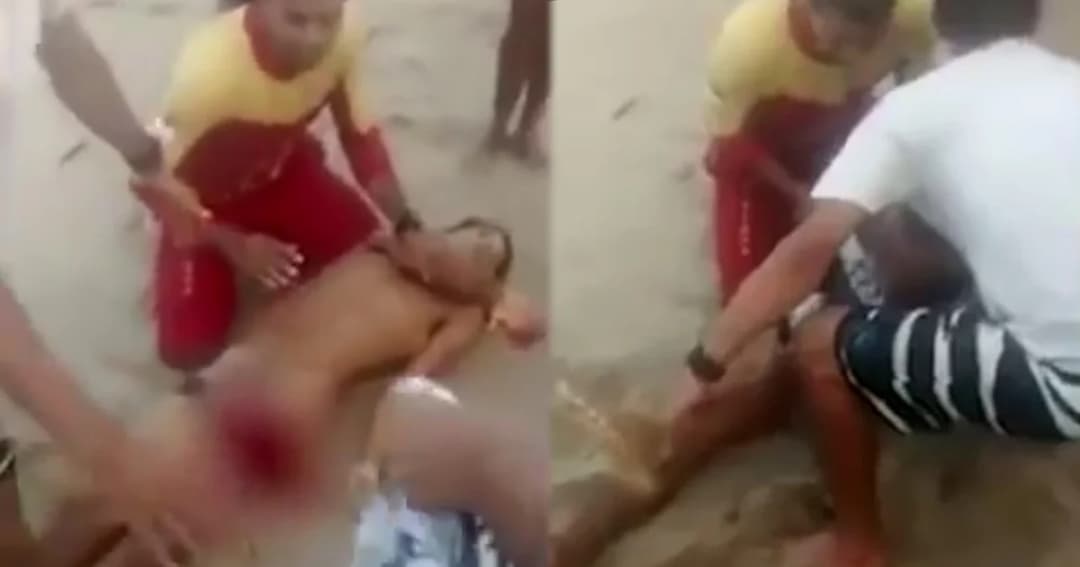 หนุ่มบราซิลวัย 18 ดับ หลังโดนฉลามงับเจ้าโลกขาด