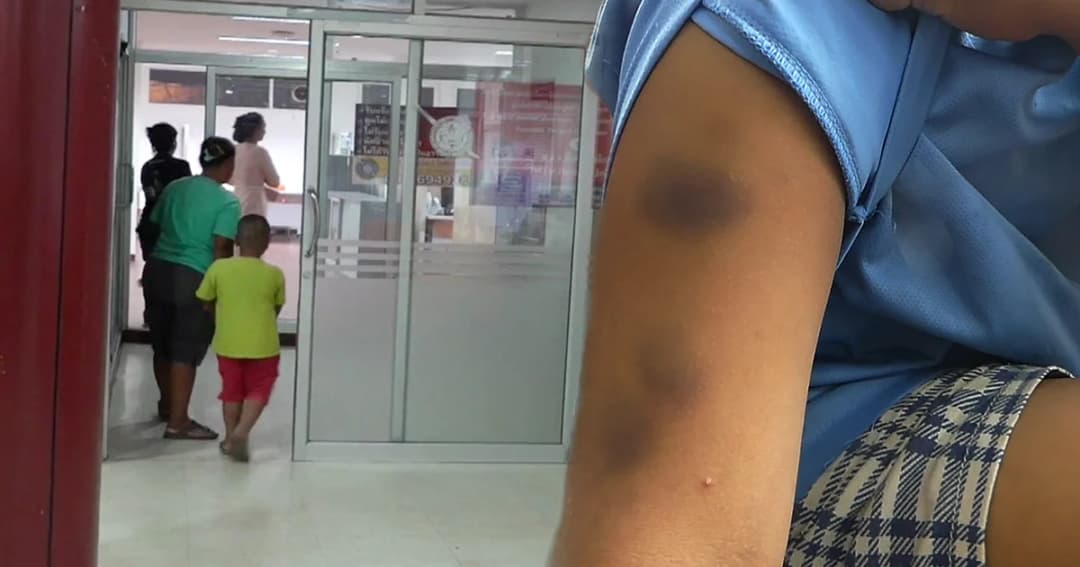 แม่โวย ! ครูสาวลงโทษหนัก ตี-หยิก-หักนิ้ว ด.ช. 5 ขวบ เตรียมย้ายลูกเรียนที่อื่น