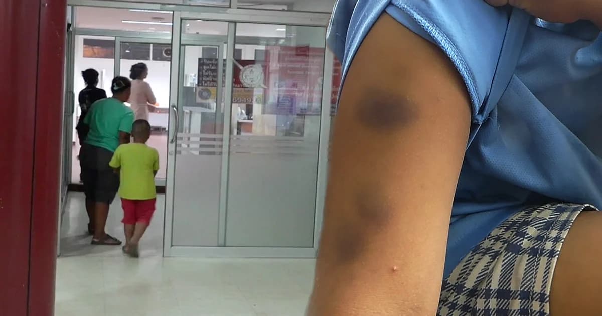 แม่โวย ! ครูสาวลงโทษหนัก ตี-หยิก-หักนิ้ว ด.ช. 5 ขวบ เตรียมย้ายลูกเรียนที่อื่น