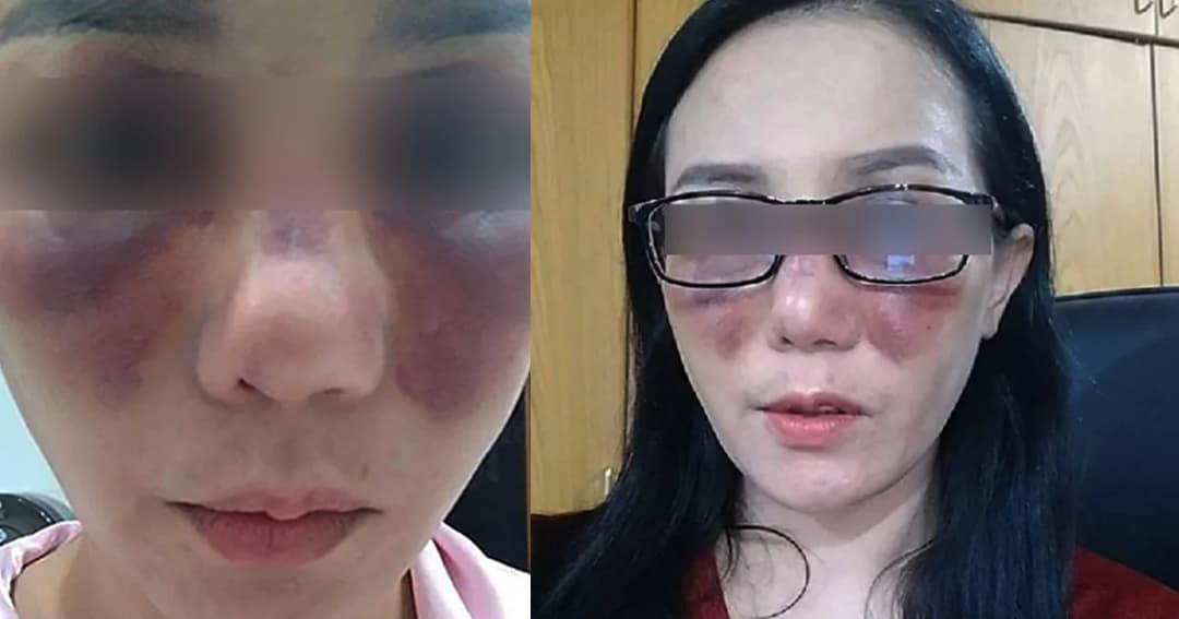 ร.ต.ท.หญิง ร้องคลินิกศัลยกรรม เมืองลำปาง ทำหน้าพัง ไม่รับความผิด