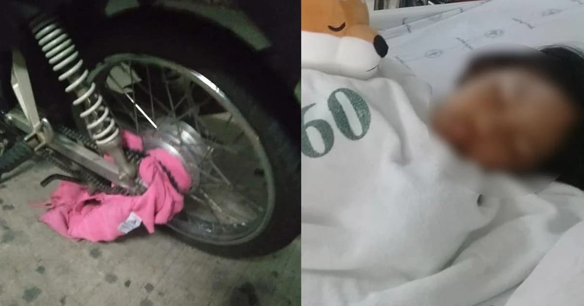 วอนช่วยเด็ก 5 ขวบ หลังซ้อน จยย.แม่ เสื้อพันโซ่ฉุดแขนขาด สมองกระเทือนแรง