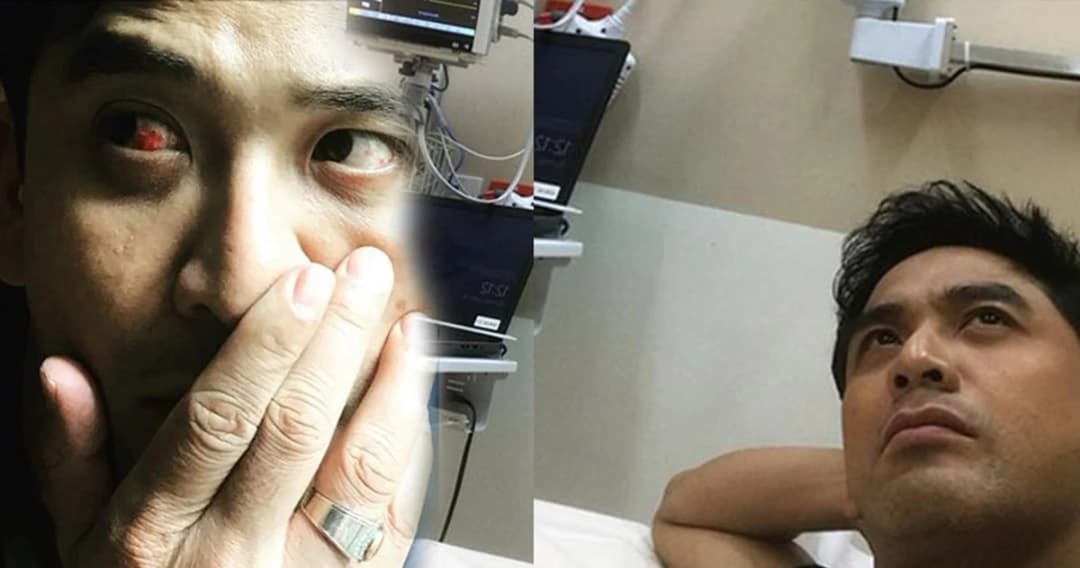 “ป๋อ” ทุ่มเทงานหนักจัด เลือดคั่งตาแดง จนน่ากลัว!