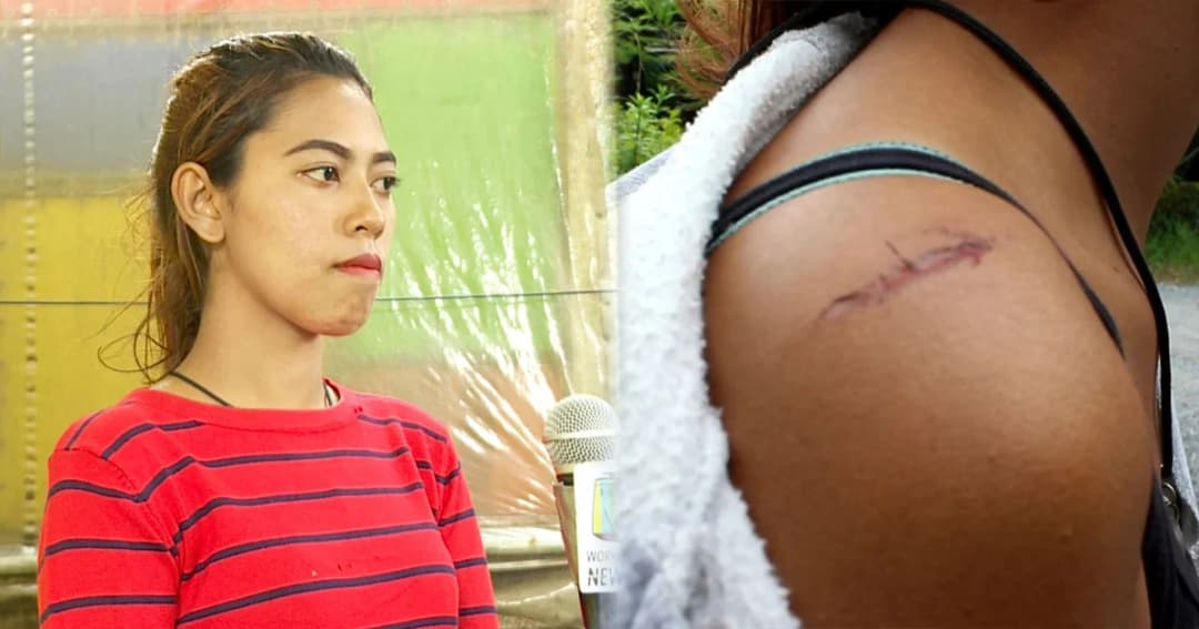 สาวรอดตายหลังแก๊งวัยรุ่นใช้มีดฟัน – คืนเดียวก่อเหตุเพียบ