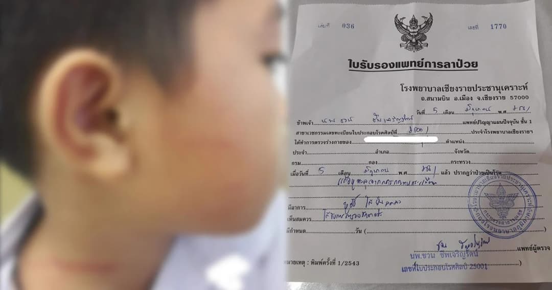 แม่ร้อง! ผอ. ตบเด็กพิเศษ จนแก้วหูทะลุ บังคับให้เซ็นย้ายลูกไปเรียนที่อื่น