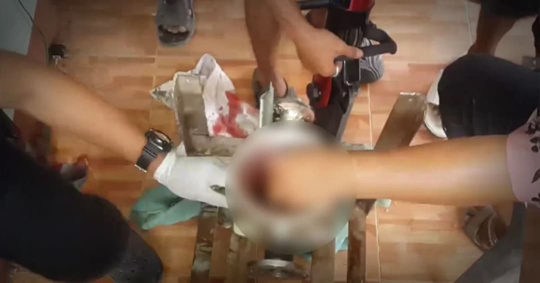 หวาดเสียว ! กู้ภัยเมืองคอนเร่งช่วยสาวใหญ่ มือติดเครื่องบดหมู นิ้วชี้ซ้ายขาด