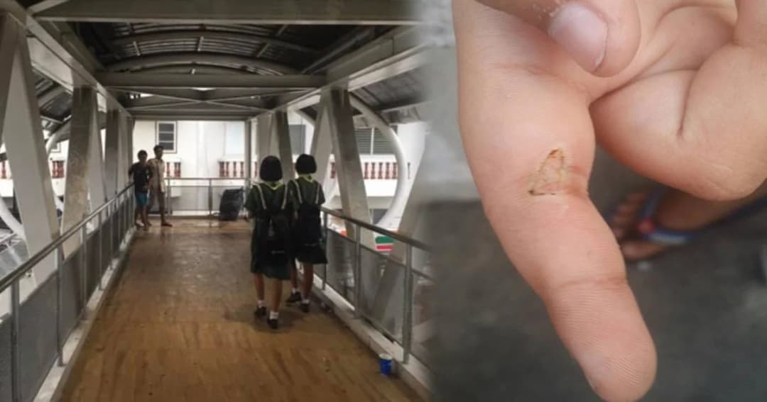 เตือนภัย! ราวเหล็กสะพานลอย หน้า รร. เมืองพัทยา ไฟรั่วช็อต นร.