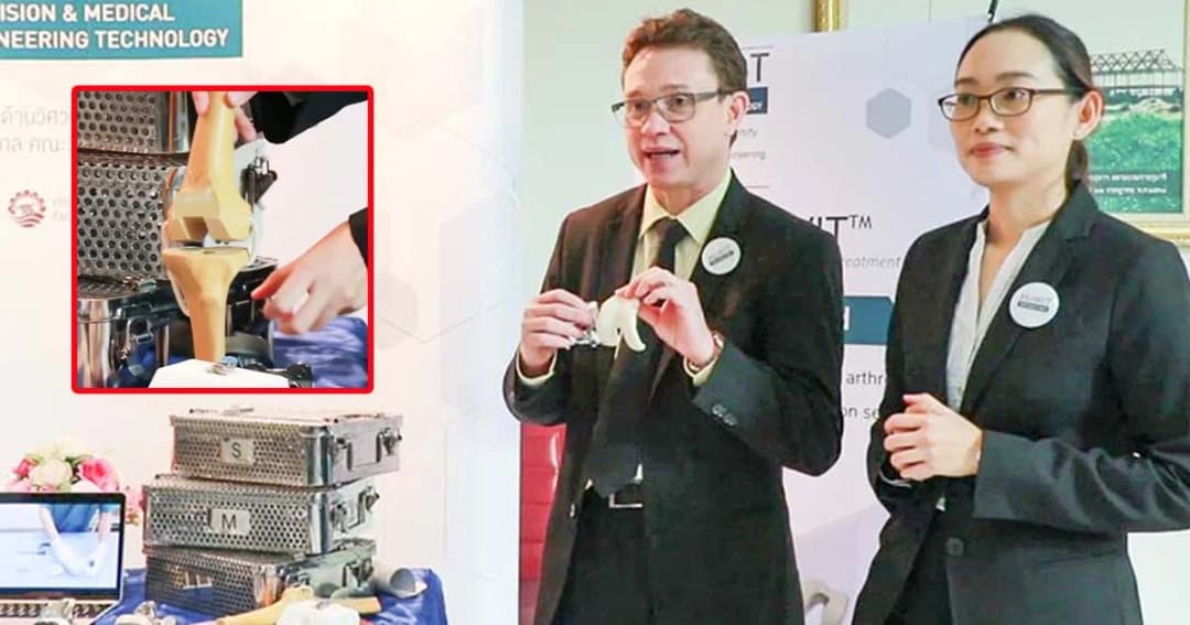 นวัตกรรมใหม่รักษาข้อเข่าเทียมติดเชื้อ “แม่พิมพ์ซีเมนต์กระดูก” ผลงานวิจัย มน.