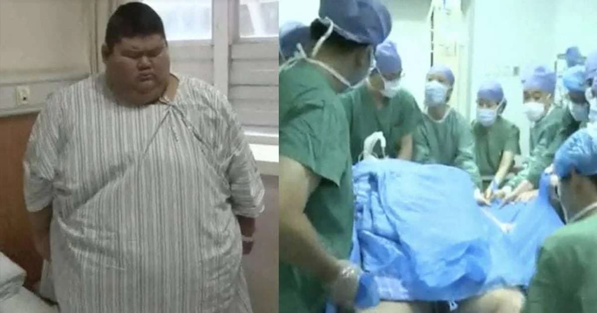 หนุ่มจีนหนัก 334 กก. เข้าผ่าตัดลดความอ้วน ฝันอยากเป็นเทรนเนอร์