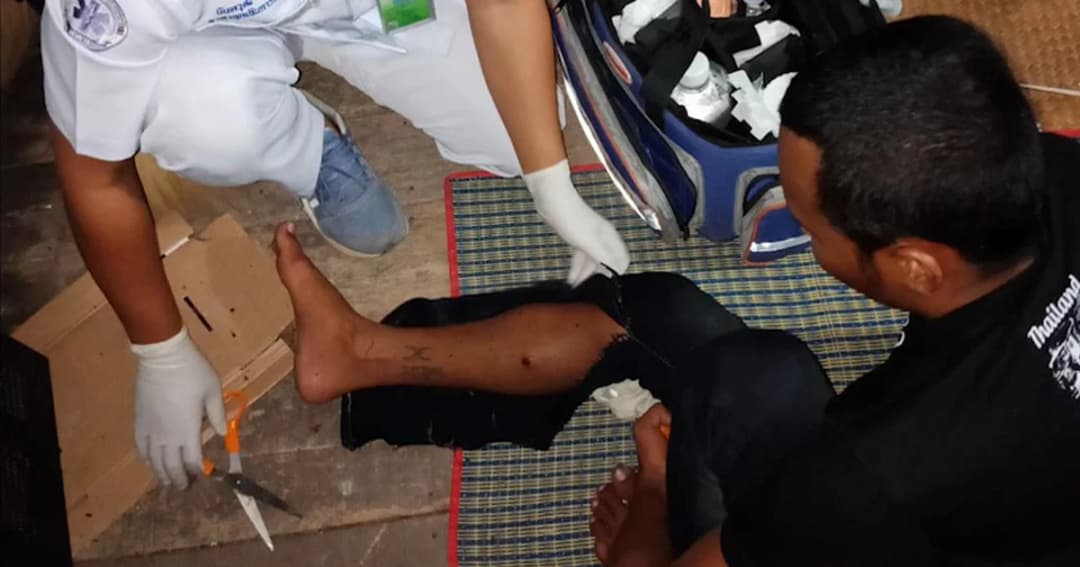 หนุ่มลองของผ้ายันต์ใหม่! สุดท้ายผ้ายังอยู่ แต่กระสุนฝังขา ได้รับบาดเจ็บ