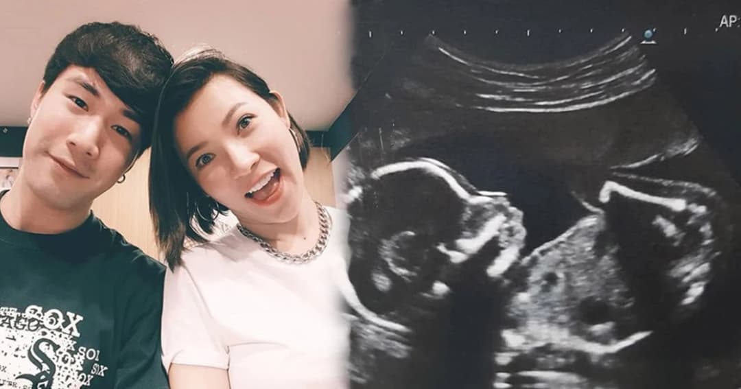 เตรียมตัวเป็นคุณแม่! “ต้นหอม” เผยภาพอัลตราซาวด์ แฟนๆ แห่ยินดี