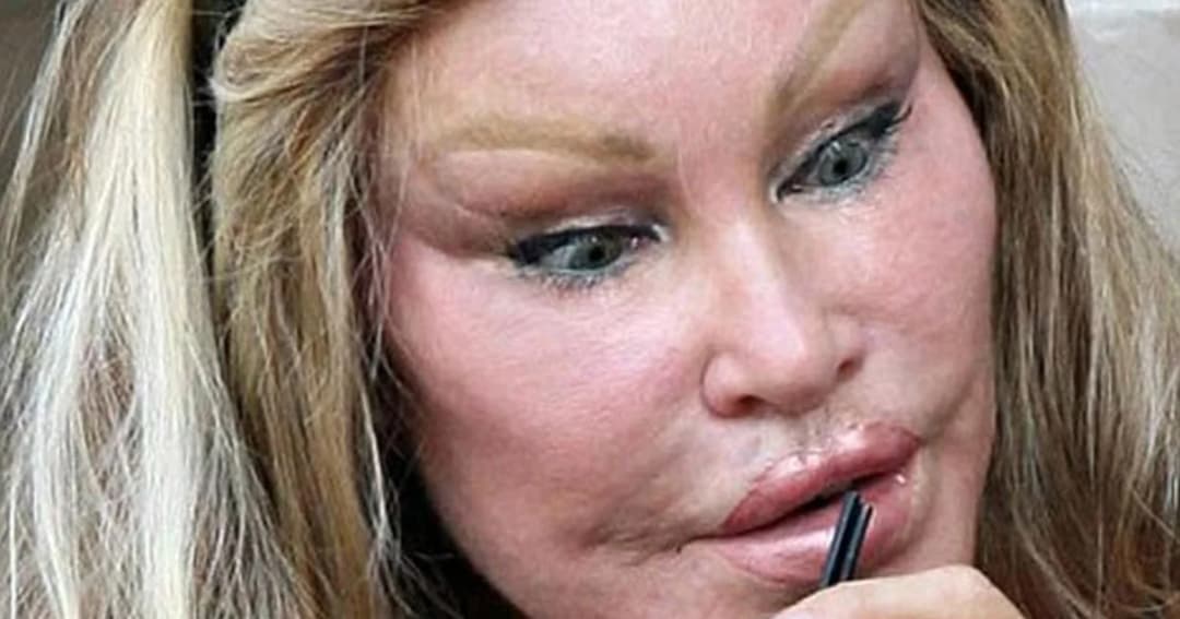 ล้มละลาย ! ‘สาวหน้าแมว’ เศรษฐีนีพันล้าน ไม่เหลือเงินในบัญชีสักดอลลาร์!