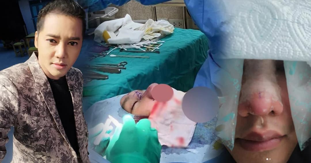 “ดีเจเจ๊แหม่ม” ขึ้นเตียงทำหน้าใหม่อีกครั้ง เผยทำครั้งเดียวแล้วอยู่ไปจนตายไม่ได้