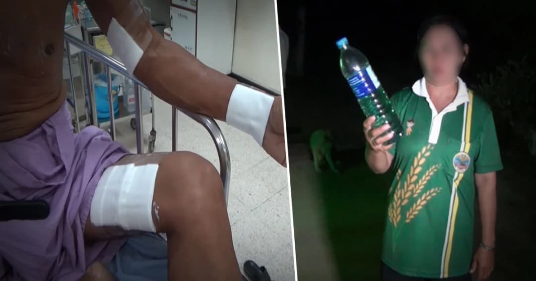 เมียหึงโหด ! ใช้น้ำมันราดตัวเองพร้อมผัว หวังจบชีวิตคู่ เหตุระแวงมีหญิงอื่น