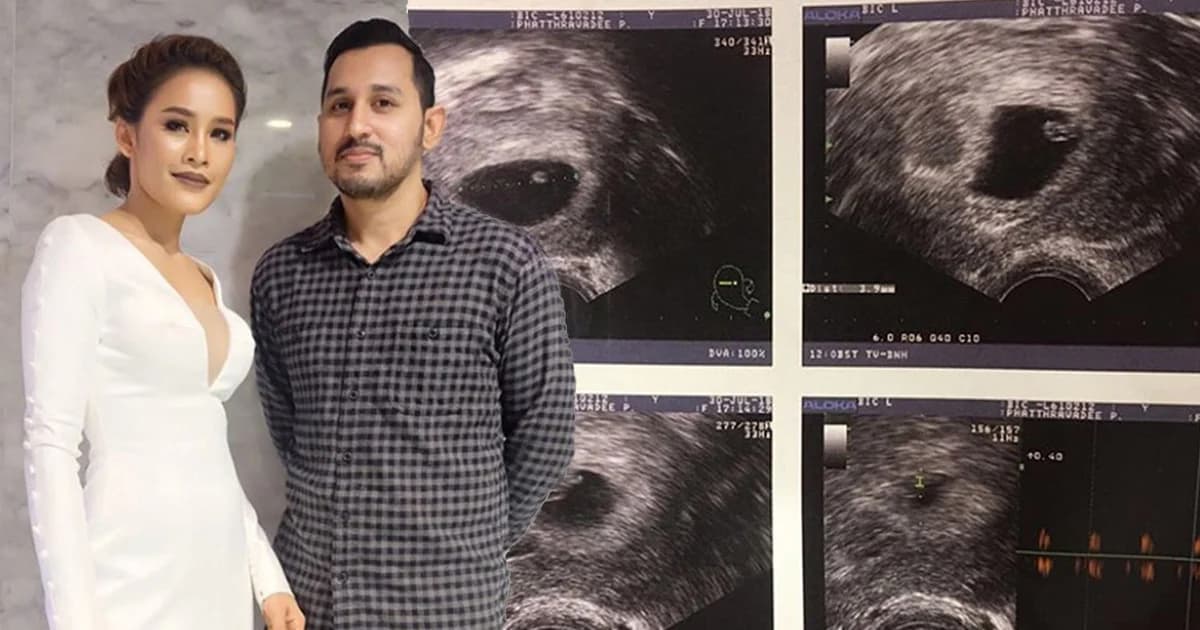 คุณแม่ป้ายแดง! “หนูเล็ก กาก้า” ตั้งครรภ์แล้ว 6 สัปดาห์