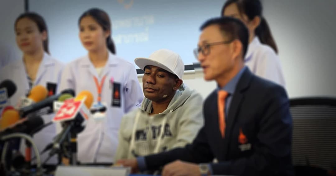 ‘โจอี้ บาซู’ ป่วยหลอดเลือดสมองตีบอาการดีขึ้น แต่ตาซ้ายบอดสนิท