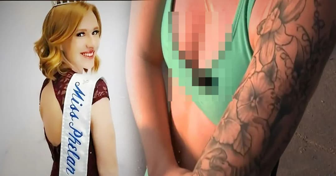 นางงามฟีแลนประกาศคืนมงกุฎ หลังกองประกวดขอให้ ‘ปกปิดรอยสัก’