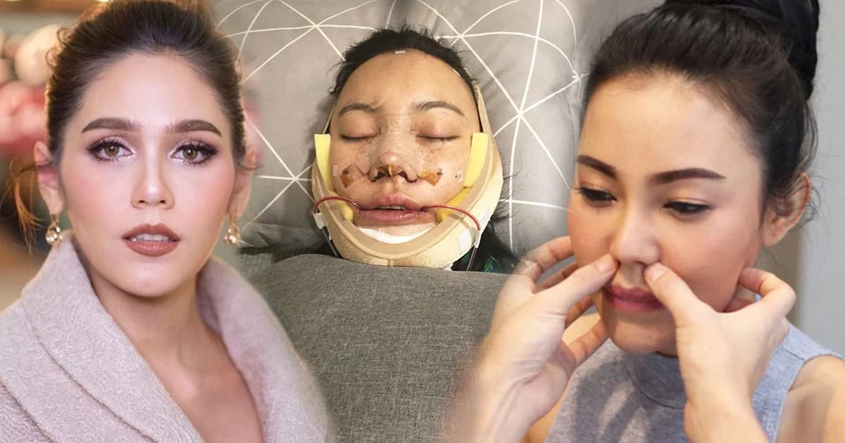 “เอ็มมี่” ทุ่มเงิน 3 ล้าน บินทุบหน้าถึงเกาหลี เผย อยากสวยเหมือน “ชมพู่ อารยา”