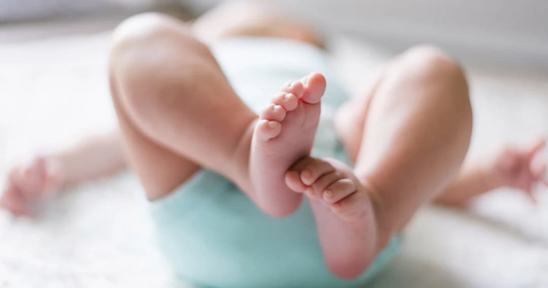 เตือนภัยพ่อแม่เห็นลูกเล็กเดินแปลก อาจเป็นโรค ‘เอ็นข้อหย่อน’