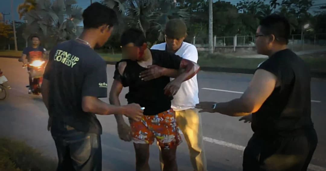 อุทาหรณ์หัดซิ่ง ! โจ๋วัย 17 ขี่จยย.ยกล้อ พลาดท่าล้มเจ็บสาหัส