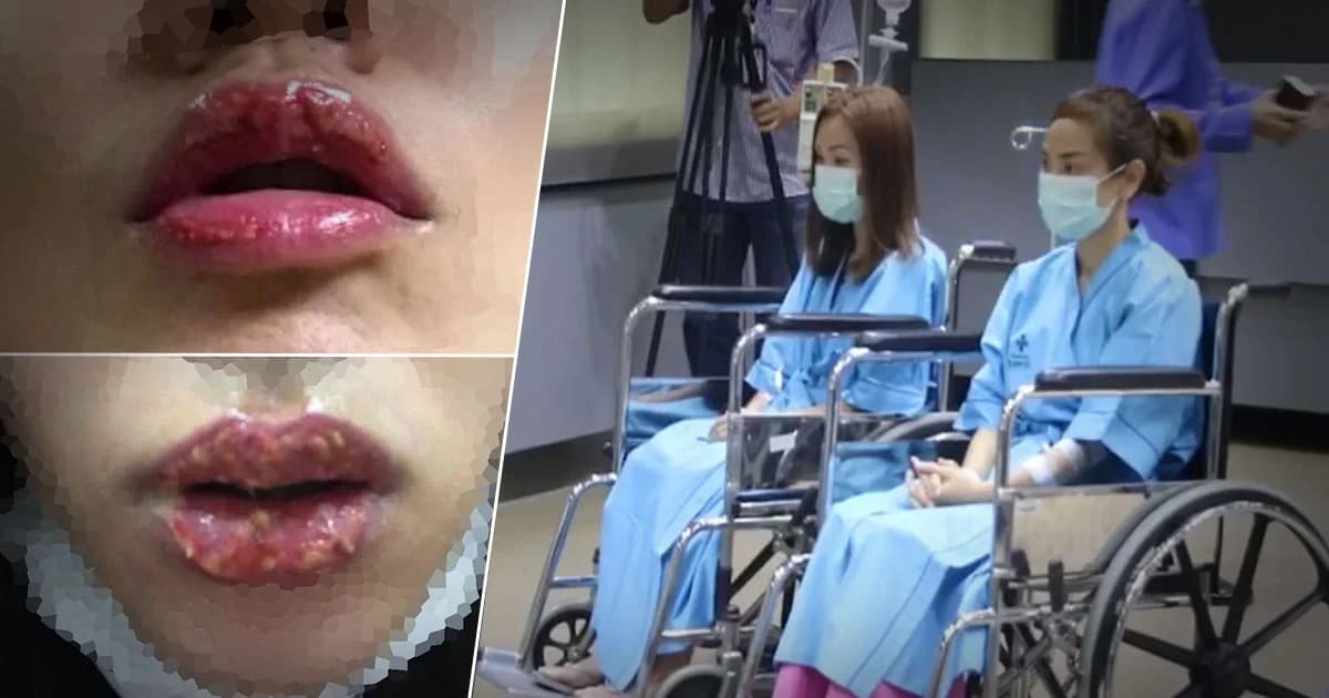 2 สาวสักปากชมพู ร้อง ! ร้านพริตตี้ดังทำปากเน่า-เป็นหนอง ไร้ความรับผิดชอบ