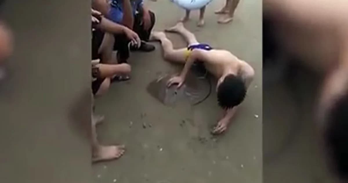 ร้องจ๊าก! หนุ่มจีนโดนเงี่ยงกระเบนแทง “น้องชาย” นอนทรมาน