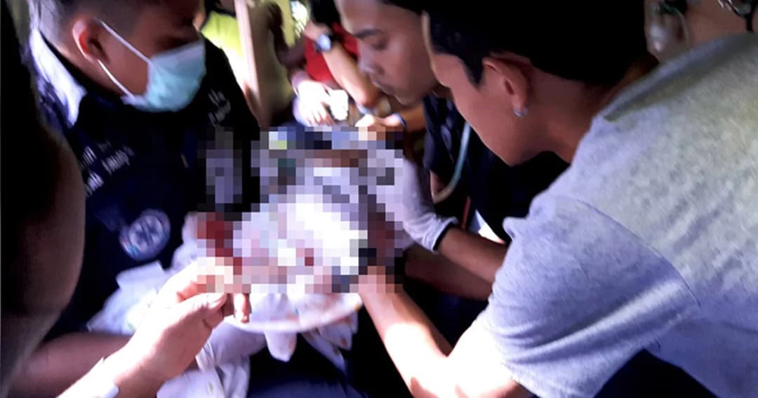 ทารกวัย 19 วัน ถูกสุนัขจรจัดขย้ำใบหน้า ศีรษะ และลำคอ อาการสาหัส