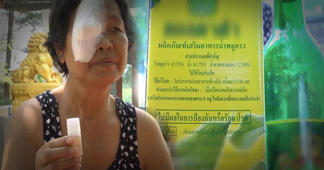 สสจ.ขอนแก่น จ่อเอาผิดตัวแทนขายสมุนไพรน้ำพลูคาว ทำยายวัย 56 ปี ตาบอด