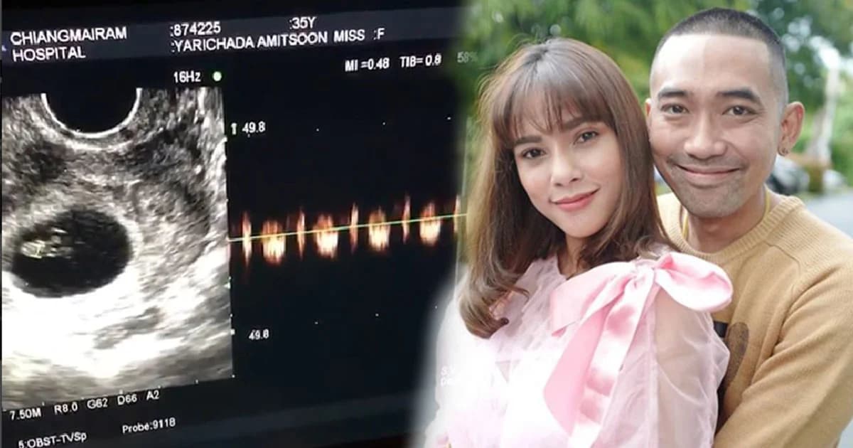 “อุ้ม ลักขณา”น้ำตาไหล หลังอัลตร้าซาวด์ได้ยินเสียงหัวใจลูก