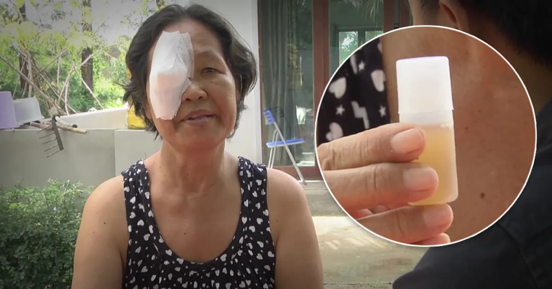 เซลส์ขายน้ำสมุนไพร ปัดบังคับ ‘ป้าวัย 56’ ให้หยอดตารักษาต้อ เผยแค่แนะนำ