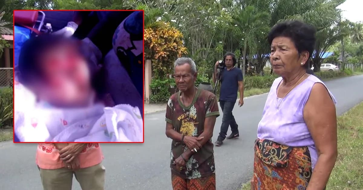 ชาวบ้านผวา! ‘พิษสุนัขบ้า’ ระบาด หลังทารกถูกหมาบ้าขย้ำ อาการยังน่าห่วง