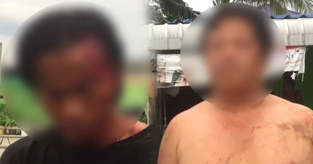 ตั้งวงดื่มเหล้าอยู่ดีๆ เปิดศึกตีกันจนหัวแตก เหตุเพื่อนรักจับนมเมีย