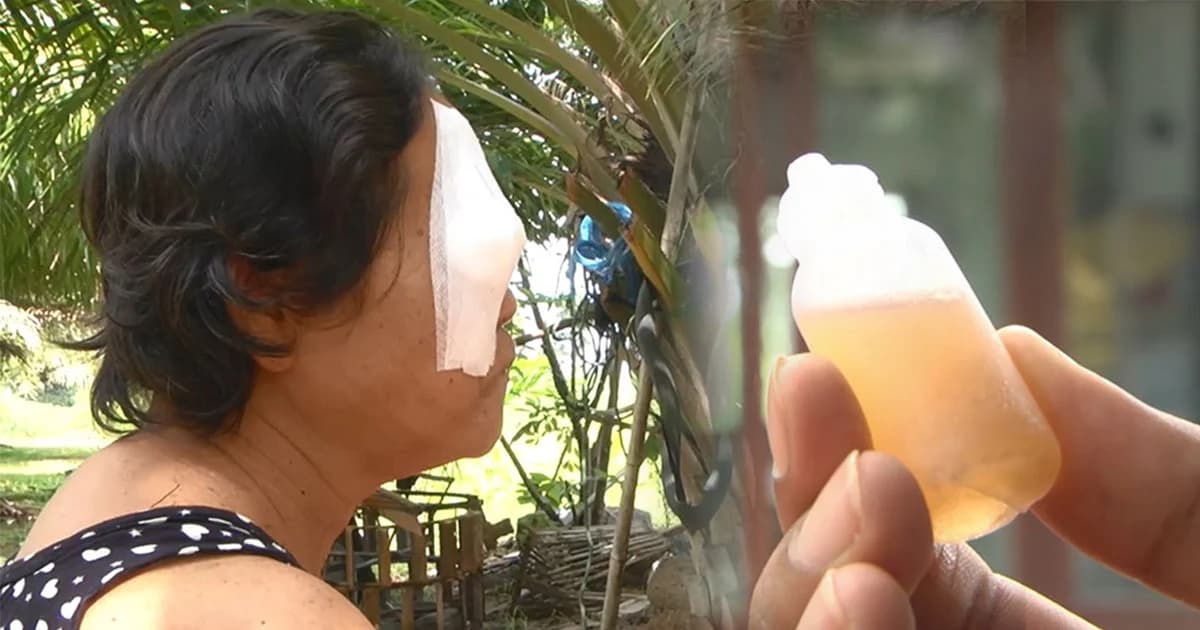 สาธารณสุขขอนแก่น เตรียมทำตาเทียม ให้ “หญิงตาบอด” จากน้ำสมุนไพร