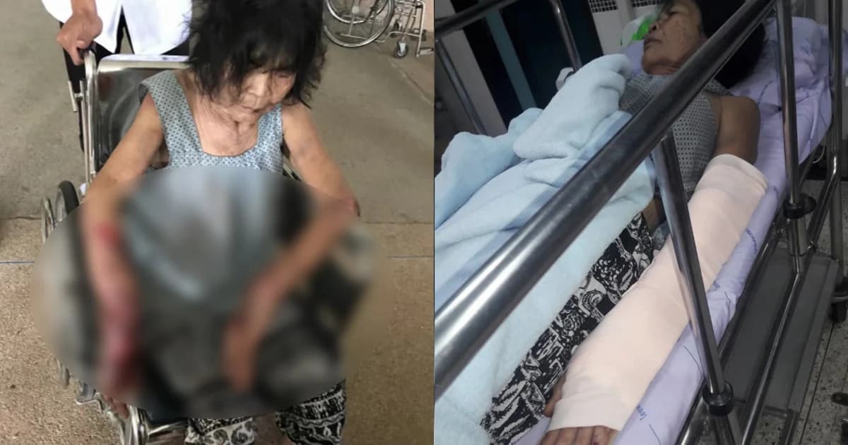 หนุ่มอุบลฯ คลั่ง หักแขนยายวัย 74 ปี สาหัส หลังขอเงินไม่ได้